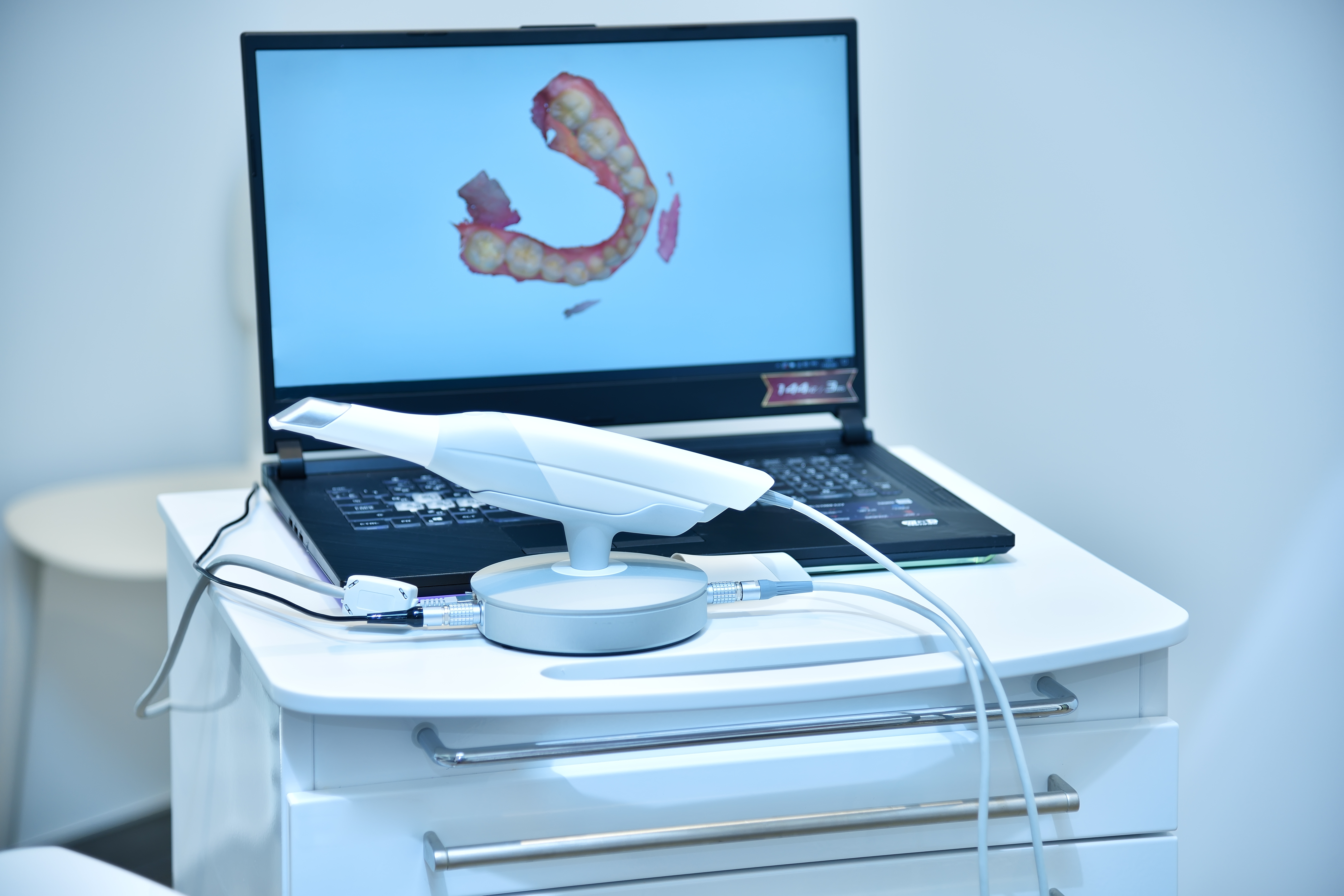 Dental Technology in Tacoma WA | My Tacoma Dentist-David Wagner DDS ...